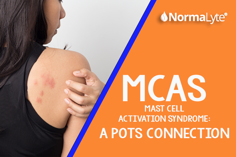 MCAS: A POTS Connection